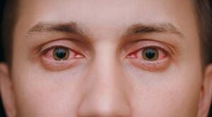 bagaimana cara menjaga kesehatan mata